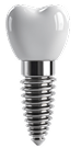 3d Implant Tooth